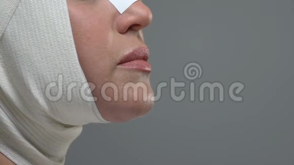 女性面部侧面贴弹力绷带整容康复视频的预览图