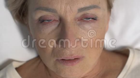 患病妇女头痛剧烈长期偏头痛面部特写视频的预览图