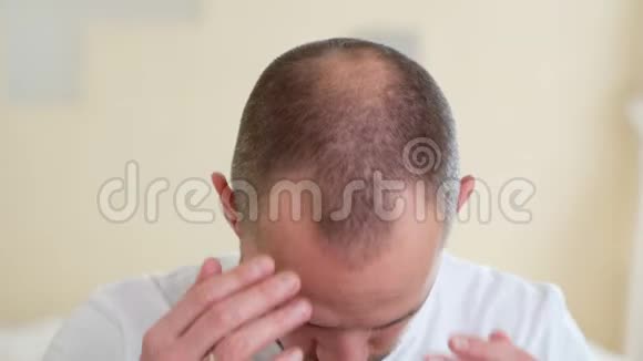人类脱发或脱发成年男子的手指向他的秃头视频的预览图