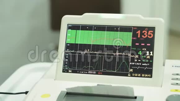 心电图监测心电图胎儿在子宫内心跳测量过程中心电图显示计量视频的预览图