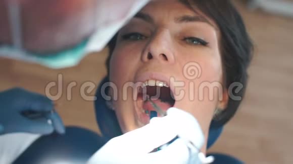 医生用工具检查一个张开嘴的女孩的牙齿视频的预览图