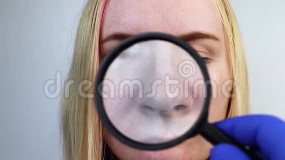 毛孔粗大黑点痤疮酒渣鼻特写在脸颊上一名妇女正在接受医生的检查皮肤科医生检查视频的预览图