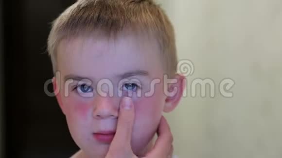 孩子脸晒伤母亲用手摸孩子脸视频的预览图