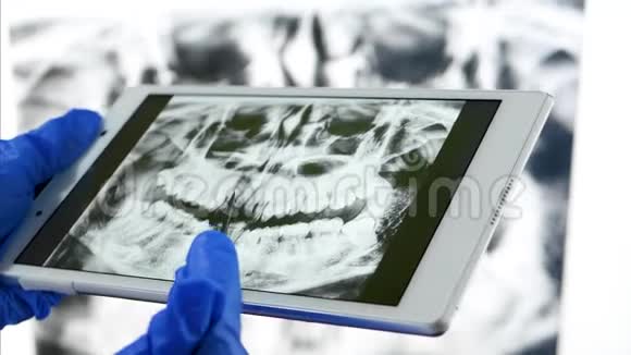 牙医使用的是一块带有下巴x光图像的药片咬诊牙套系统和现代医学视频的预览图