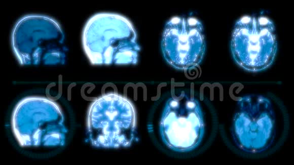 人脑数字MRI扫描数据视频的预览图