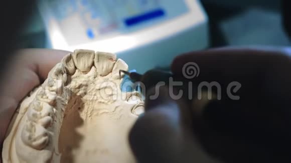 牙医医生在下巴上做假牙牙科医生手里拿着一个下巴植入物用这种材料视频的预览图