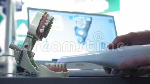 牙齿手动3D扫描仪医生扫描下巴上的一颗牙齿牙医扫描牙齿新技术视频的预览图