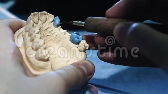 牙医医生在下巴上做假牙牙科医生手里拿着一个下巴植入物用这种材料视频的预览图