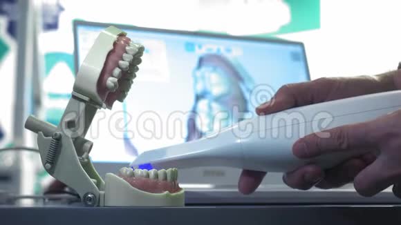 牙齿手动3D扫描仪医生扫描下巴上的一颗牙齿牙医扫描牙齿新技术视频的预览图