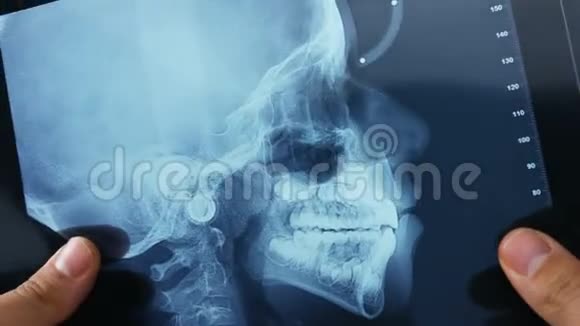医生在检查一个X光头骨的孩子视频的预览图