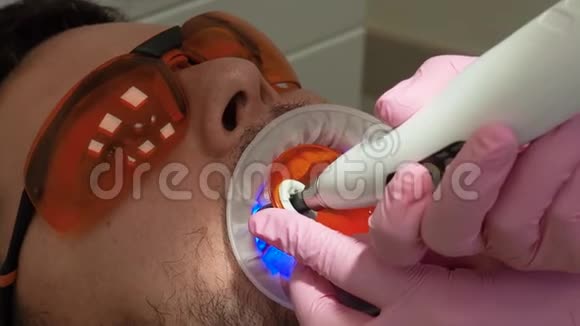医学牙科和医疗保健概念牙科治疗紫外线灯的特写及局部透视视频的预览图