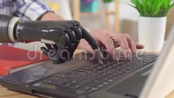 有假手臂的年轻人正在电脑旁工作视频的预览图