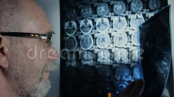一位戴眼镜的老年科学家回顾脑部核磁共振视频的预览图