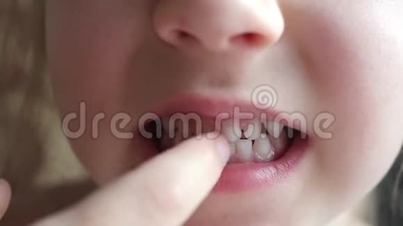 女童首次获得牛奶临时牙齿视频的预览图