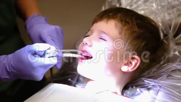 快乐男孩微笑着在牙医那里刷牙视频的预览图