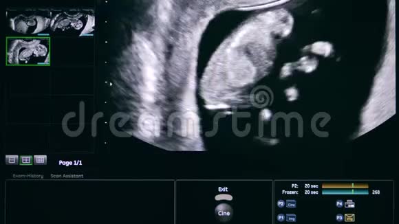 子宫里婴儿的形象视频的预览图
