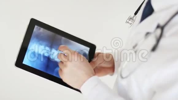 在平板电脑上进行x光扫描的医生视频的预览图
