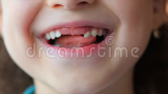 小女孩微笑宝宝的牙齿孩子摇舌乳牙视频的预览图