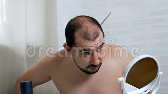 担心脱发镜子前一个秃顶的人照顾他的头发用一种方法来生长头发以防万一视频的预览图