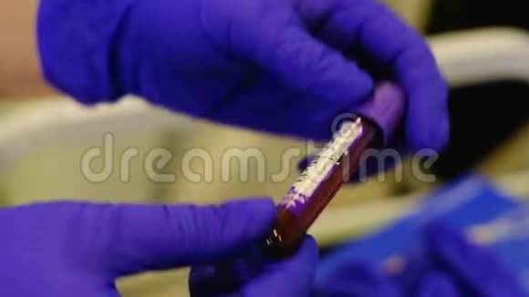 做冠状病毒测试的血液测试视频的预览图