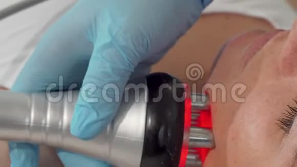 一个成熟的女人在做面部射频提升手术时视频的预览图