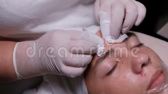 美容师挤压一个十几岁男孩额头上的痤疮美容诊所白手套的特写男性当事人视频的预览图