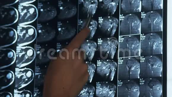 医生检查核磁共振扫描视频的预览图