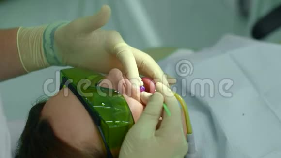 牙医用牙棒抚平物质视频的预览图