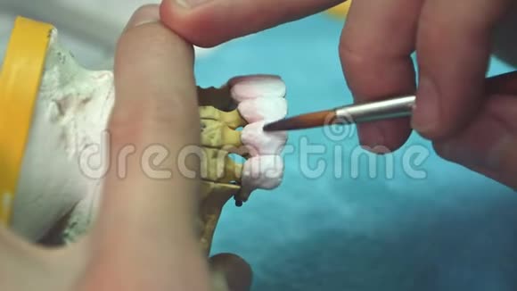 牙科技师将陶瓷釉用数控牙科机铸造而成视频的预览图