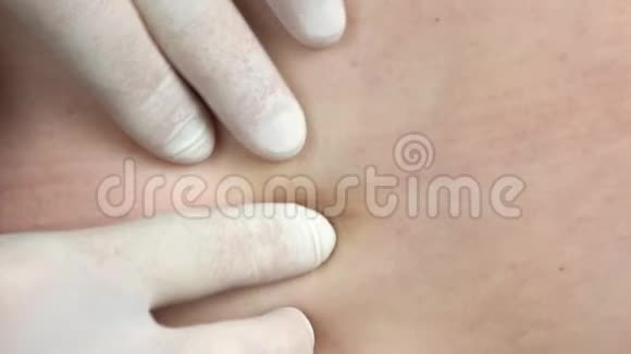 密切医生双手检查病人皮肤视频的预览图