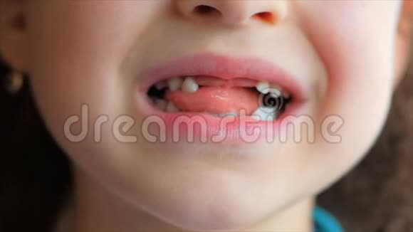 一个小女孩的特写微笑宝贝牙齿孩子咬他的舌奶牙视频的预览图