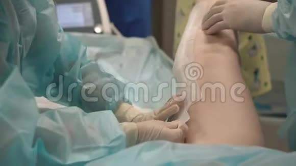 医生和护士为病人准备手术准备静脉外科手术视频的预览图