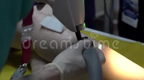 外科医生正在对病人腿做手术近距离4k视频的预览图