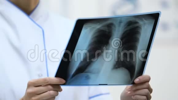 持有肺部x线的女性治疗师病人检查结果诊断视频的预览图
