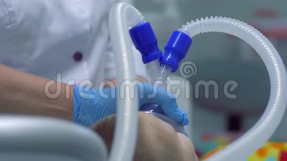病人戴上医用氧气面罩后睡着了在牙科诊所进行牙科治疗视频的预览图