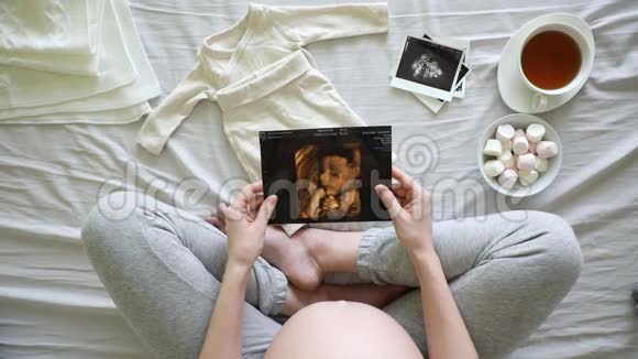 孕妇在进行超声波扫描时会碰到她的腹部视频的预览图