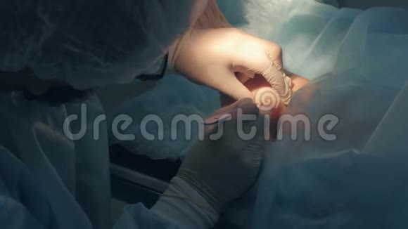 外科医生在踝关节上用手术刀做一个切口以去除关节潮气视频的预览图