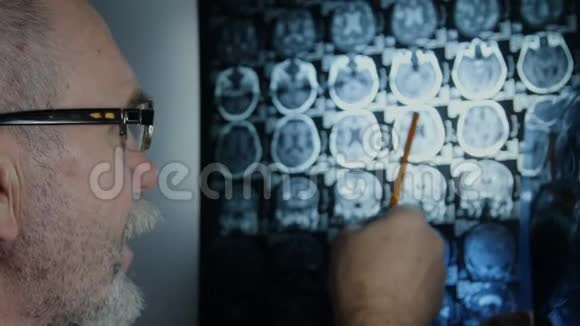 高级医生复查脑部核磁共振视频的预览图