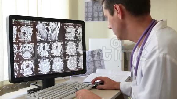 医生检查CT扫描视频的预览图