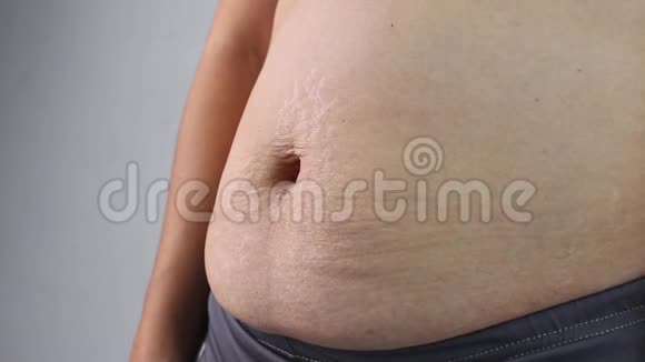 在灰色背景下女性手捏过多的腹部脂肪女人胖肚子肥胖及超重概念视频的预览图