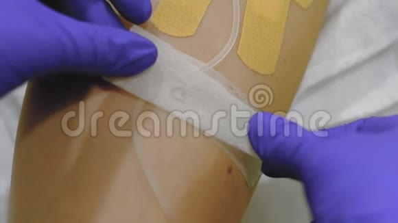 静脉输液治疗冠状病毒视频的预览图