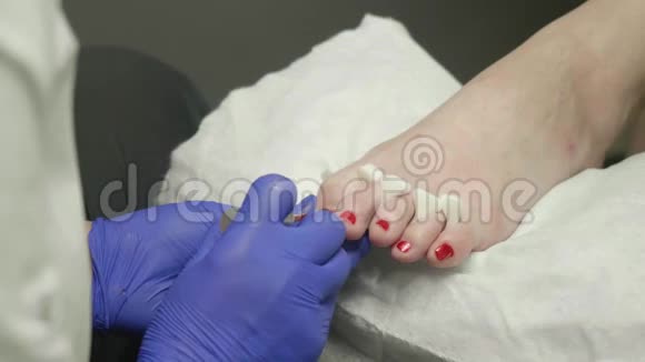 医生把红色指甲油涂在客户腿上的指甲上视频的预览图