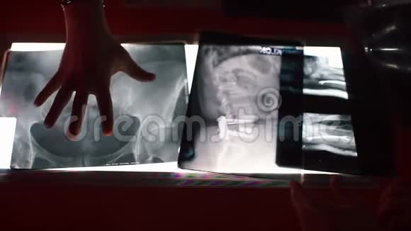 一位科学家法医学家的手指出了x射线的细节视频的预览图