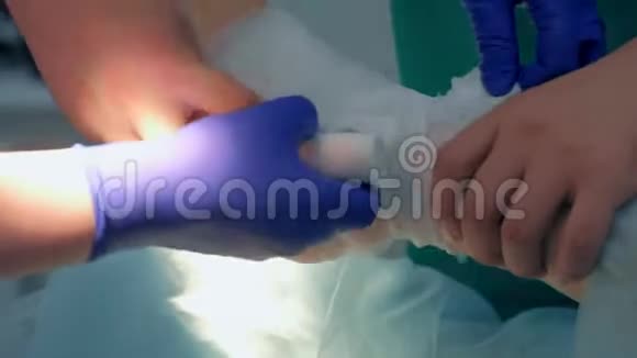 护士和医生外科医生包扎病人手术后的腿脚特写视频的预览图