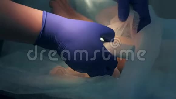 手术后护士和外科医生用绷带包扎病人的脚特写镜头视频的预览图