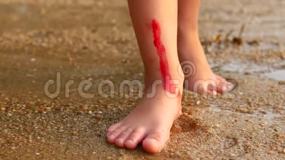 那孩子在海里的珊瑚上割伤了自己腿上有血视频的预览图