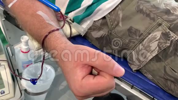 献血者的右手有针和献血系统视频的预览图
