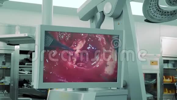 通过电子显微镜图像对人体颅骨进行手术视频的预览图