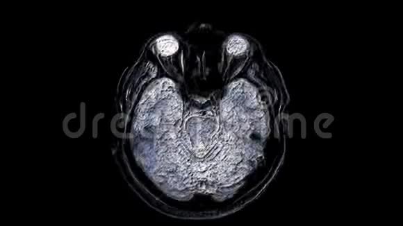 对大脑和头部进行大量的彩色MRI扫描以发现肿瘤诊断医疗工具视频的预览图