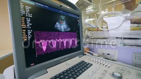 儿科医生使用超声仪检查婴儿在孵化器里视频的预览图